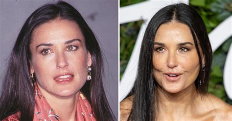 demi moore plastic surgery